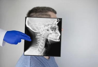 survey-radiography-skull-on-side-260nw-1748275154 X-ray of man's face shows results after facial trauma surgery.