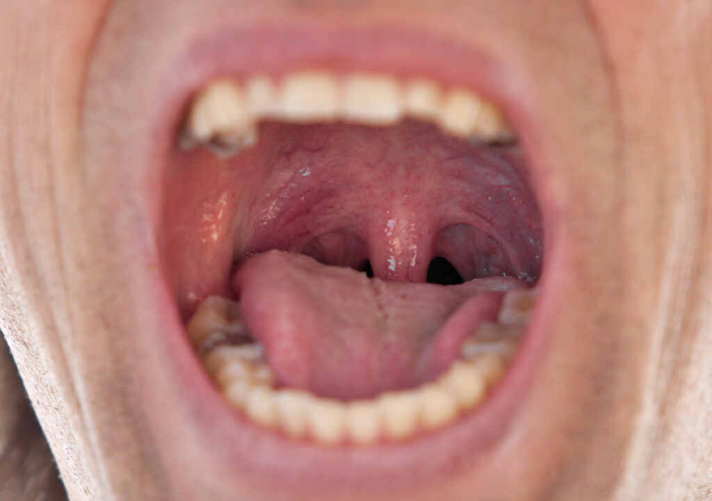 Close-up shot of a man's tongue - he screams from an injury.