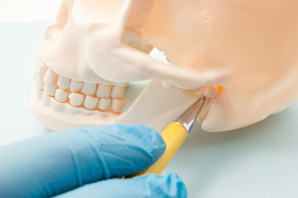 Temporomandibular,Joint,(tmj,,Joint,Of,The,Lower,Jaw),And,The Temporomandibular Joint Replacement in San Diego